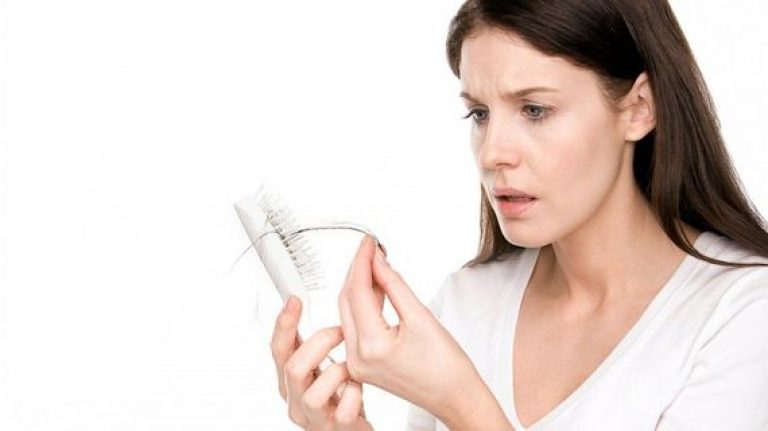 Simple Methods to Prevent Hair Loss in Women Easily!