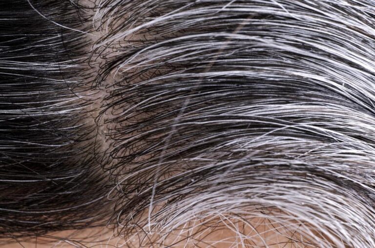 8 Causes of Gray Hair and 6 Natural Tips to Prevent Them!