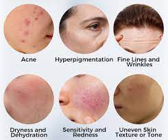 skin dryness images